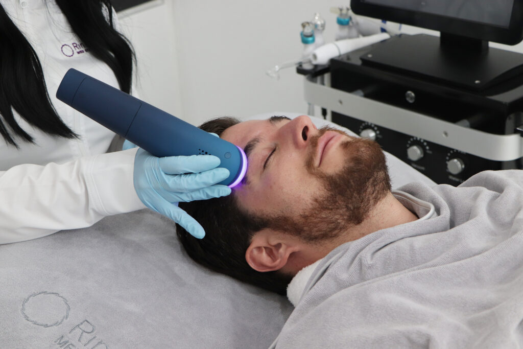 Oxigenación Facial