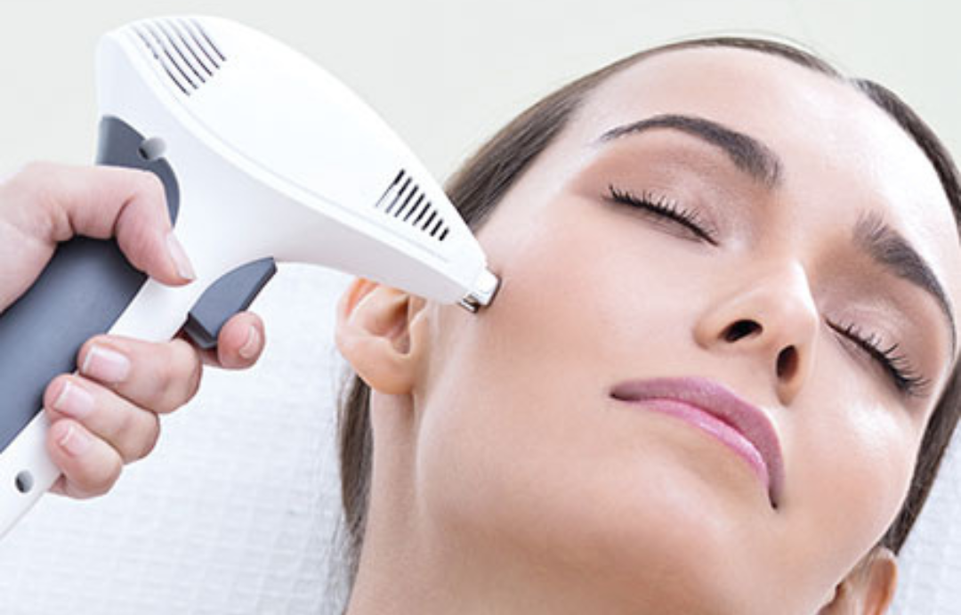 Viora V-ST — Rostro Completo
